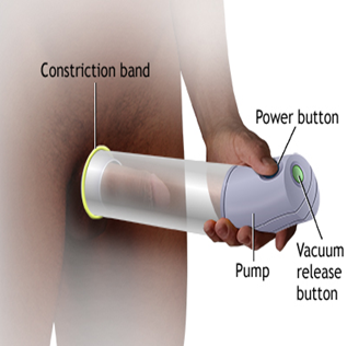 How to Use Vacuum Pump for Erectile Dysfunction? A Safe & Effective Aid Backed| HEH 2 image 5