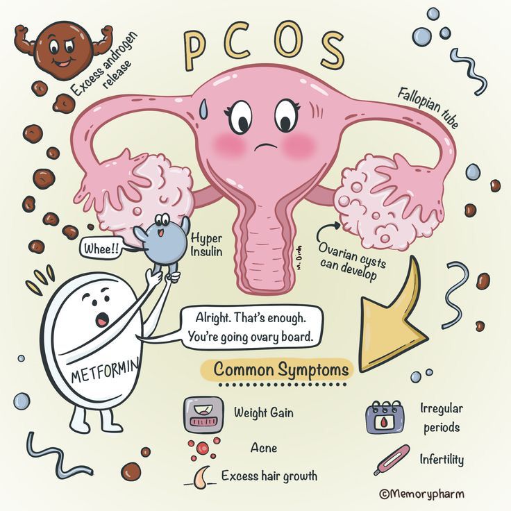 What is PCOS? Causes, Symptoms, and Treatment Facts| HEH 1 WhatsApp Image 2025 07 11 at 10.06.38 PM