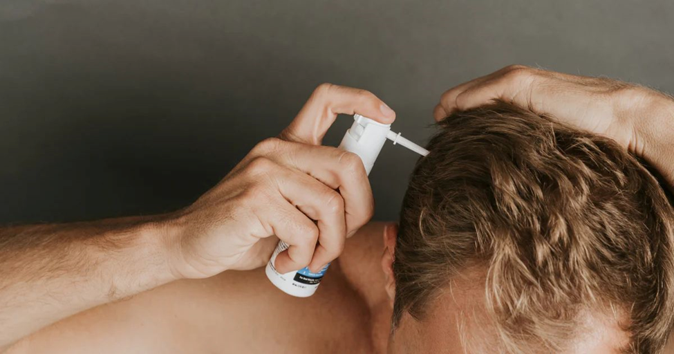 Minoxidil for Hair Fall Regrowth: Best Topical Solution for Thinning Hair| HEH 2 image 14