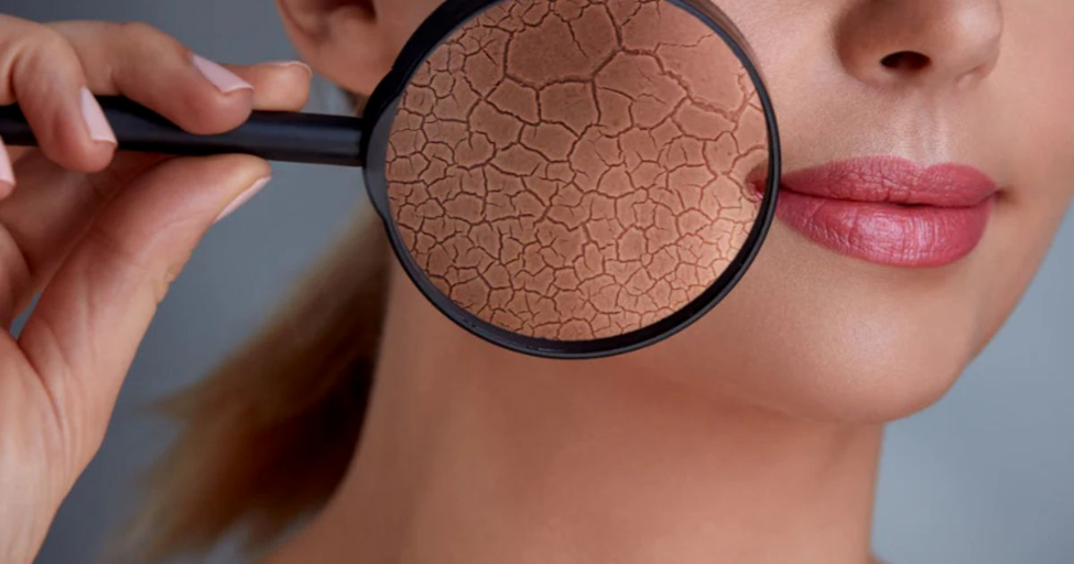 Skin Barrier Damage: Causes, Symptoms & How to Repair It Naturally| HEH 3 image 17