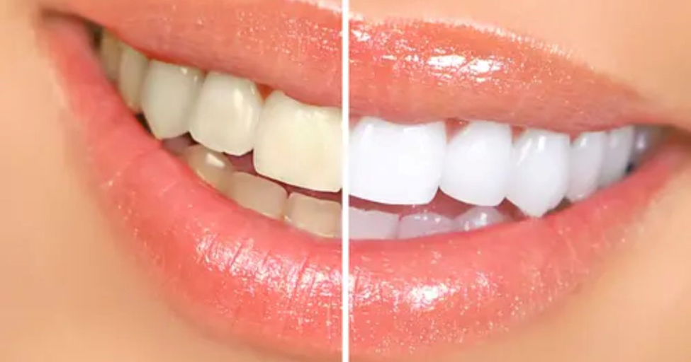 Oil Pulling Benefits, Techniques & Side Effects: Natural Oral Detox Guide| HEH 3 image 21