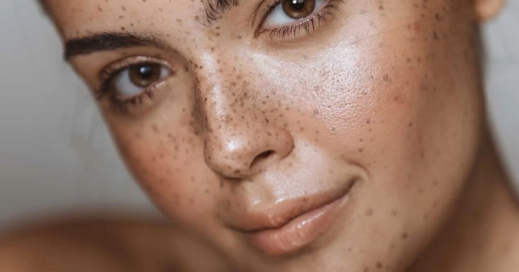 Alpha Arbutin vs Tranexamic Acid: The Ultimate Showdown for Hyperpigmentation